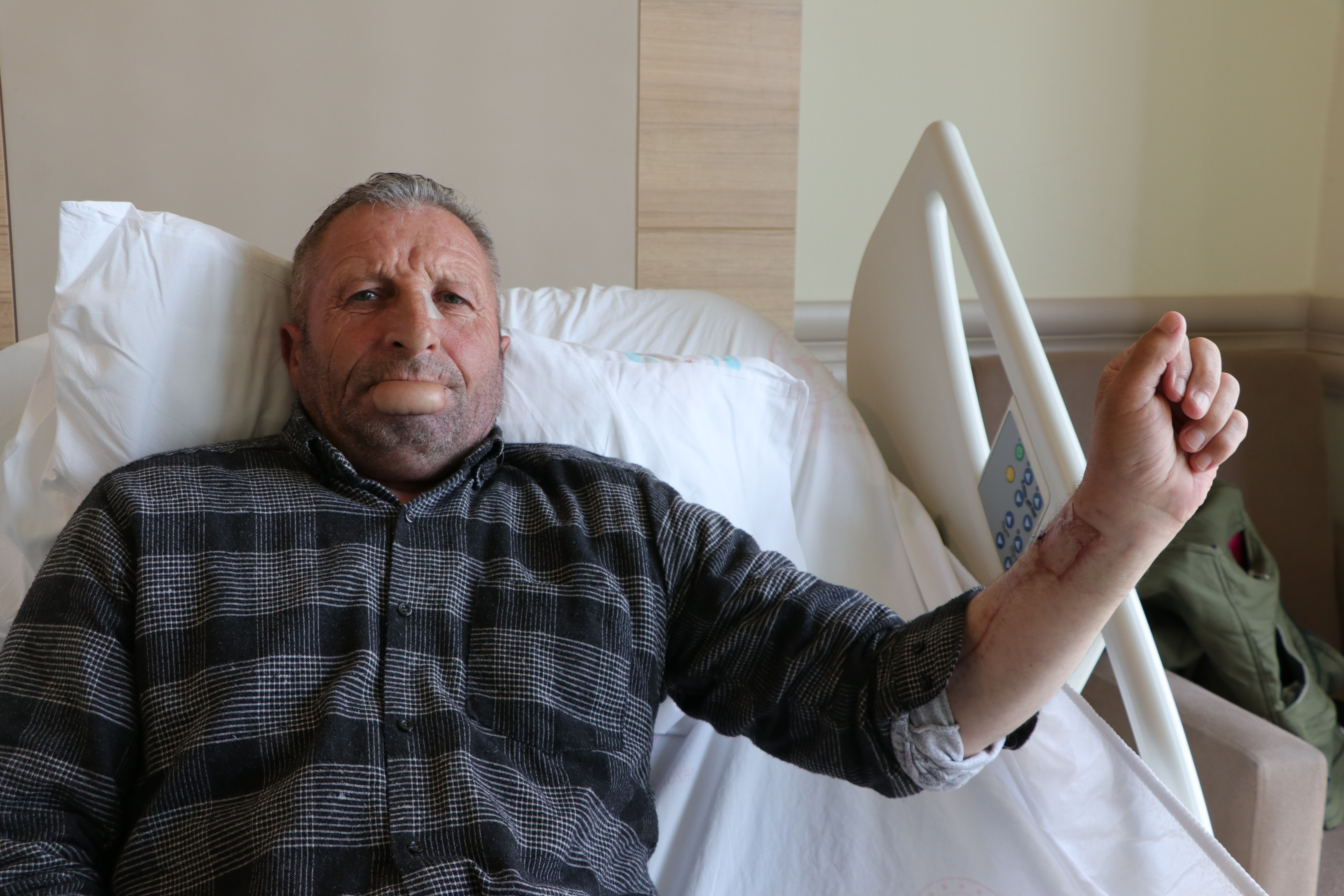 Kol derisinden yapılan dudakla sağlığına kavuştu