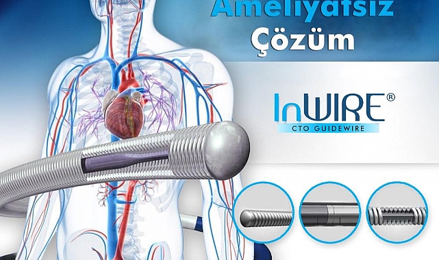 Tam tıkalı kalp damarlarına ameliyatsız çözüm