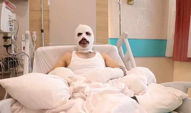 Grip yüzünden gaz kaçağını fark etmediği tüpü yakınca canından oluyordu