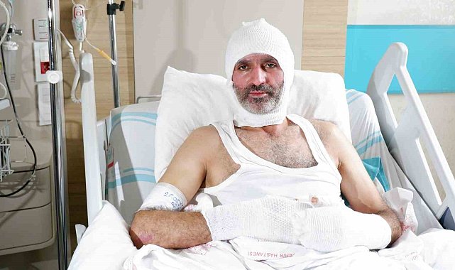 "Ben yandım, siz yanmayın"