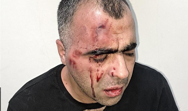 BİGACEM Başkanı Aygül'e saldırıya ilişkin 1'i polis 2 kişi gözaltına alındı