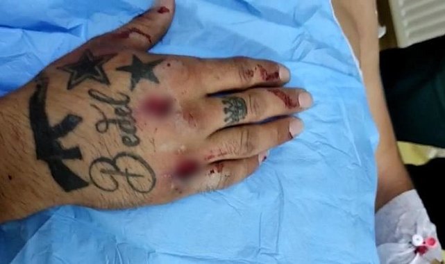 Patnos'ta ehliyetsiz motosiklet sürücüsü polis aracına çarptı