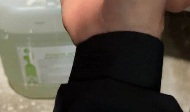 Elazığ'da parmağa sıkışan yüzüğü itfaiye ekipleri çıkardı