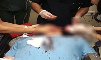 Selim'de doktor darp edildi