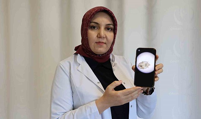 &quot;2018 yılından sonra uyuz vakasında ciddi bir artış vardı&quot;