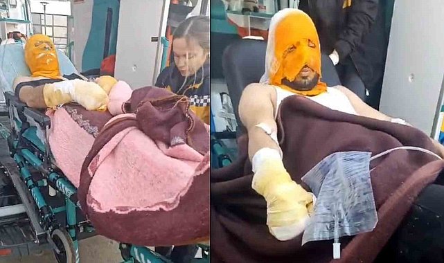 Erzincan'da trafo patlaması sonucu 2 Aras Edaş personeli yaralandı