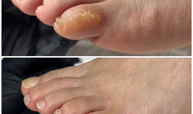 Tırnak bakımına dikkat