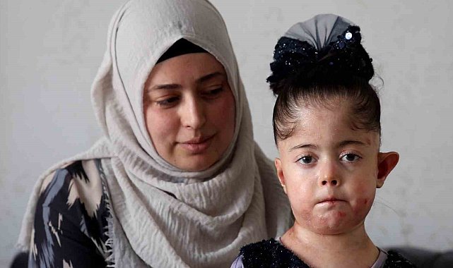 Tek dileği kelebek hastası kızına doyasıya sarılabilmek