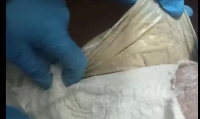 Yolcunun ayağına sarılı alçından eroin çıktı
