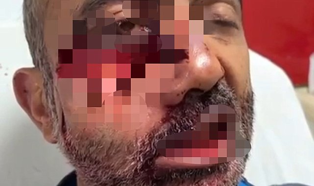 Tarlasına giden vatandaş, iki ayının saldırısına uğradı
