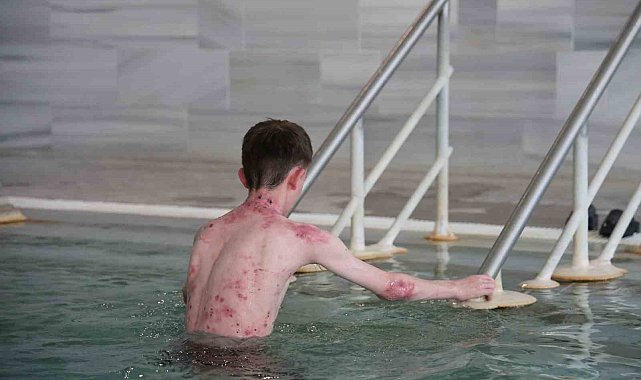 Tedavisi mümkün olmayan hastalığa bu su şifa oldu