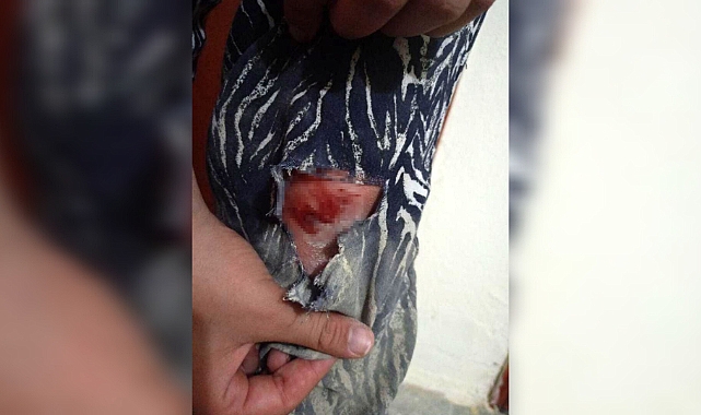 Elazığ'da başıboş köpeklerin kovaladığı şahıs yaralandı
