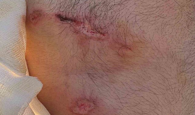 Elazığ'da abdest almaya giderken ayı saldırısına uğrayan şahıs yaralandı