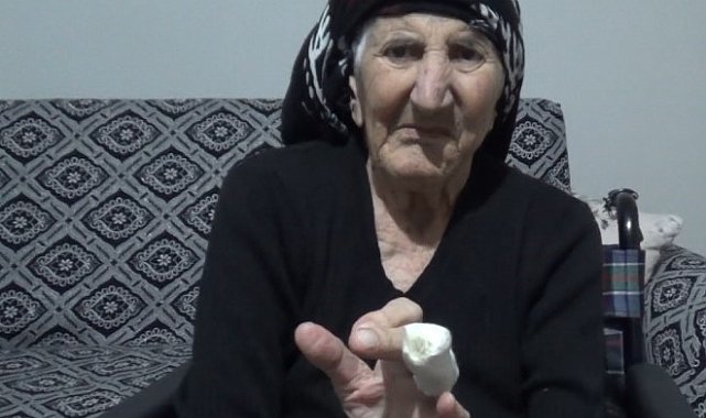 MR'da parmağı sıkışan yaşlı kadında doku kaybı meydana geldi