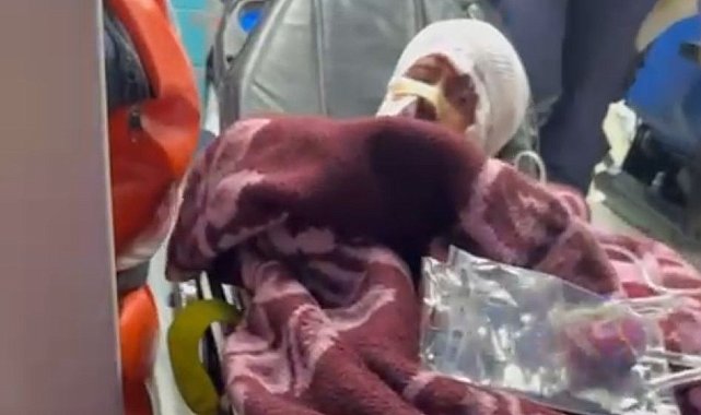 Köpek saldırısına uğrayan çocuğun babası: "Bu işe bir çözüm bulun"