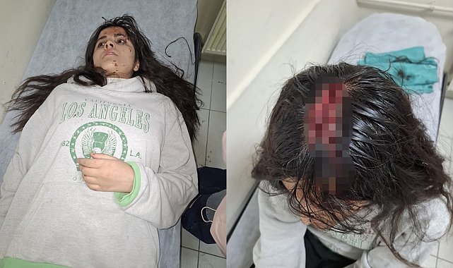 Hakkari'de başına buz kütlesi düşen genç kız yaralandı