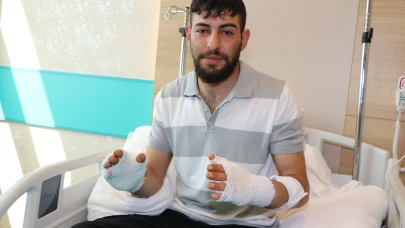 Hararet yapan otomobiline müdahale edince elleri yandı