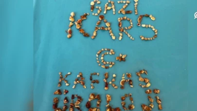 Kars'ta hastanın iki böbreğinden 300'ün üzerinde taş çıktı