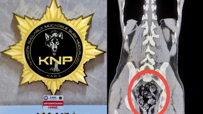 Midesinde 203,02 gram Metamfetamin ile yakalandı