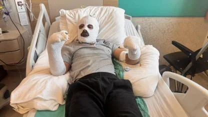 Digor'da tüp patlamasıyla yaralanan genç tedavi görüyor