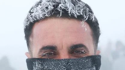 Vatandaşların kaş ve saçları kırağı tuttu