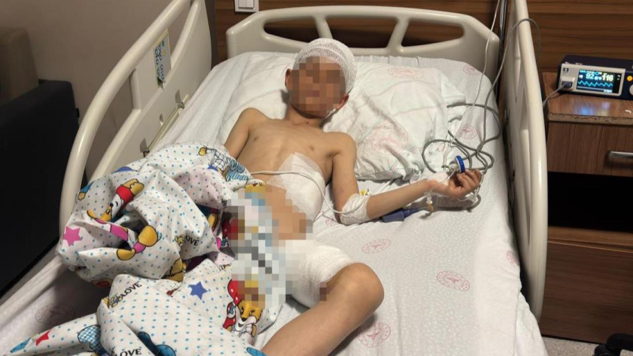 Köpek saldırısı dehşeti 5 yaşındaki çocuk hayatını kaybetti